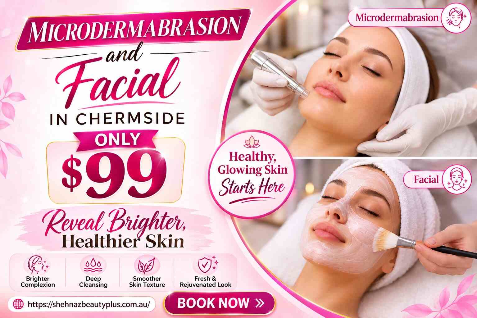 Microdermabrasion and Facial in Chermside