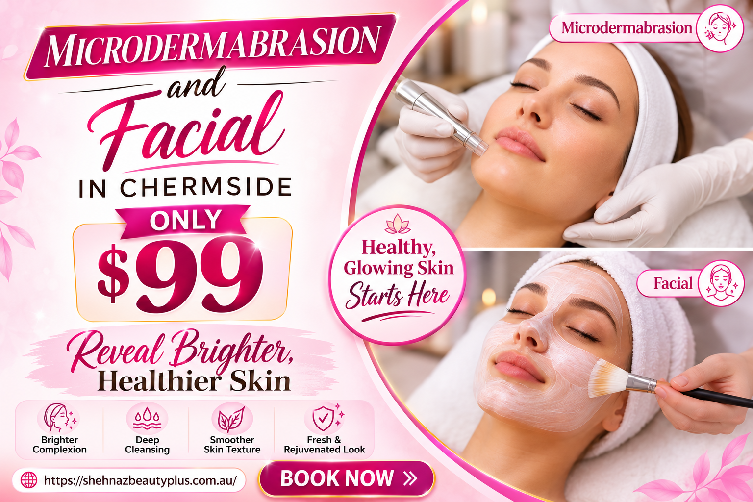 Microdermabrasion and Facial in Chermside