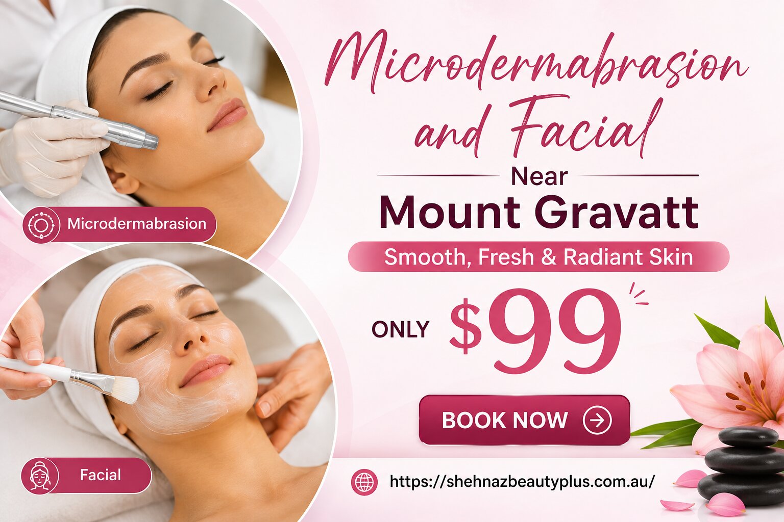Microdermabrasion and Facial Near Mount Gravat