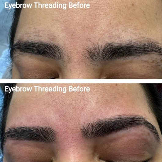 Eyebrow threading