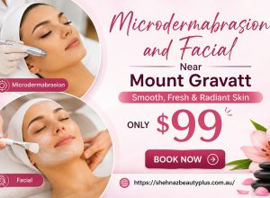 Microdermabrasion and Facial Near Mount Gravat